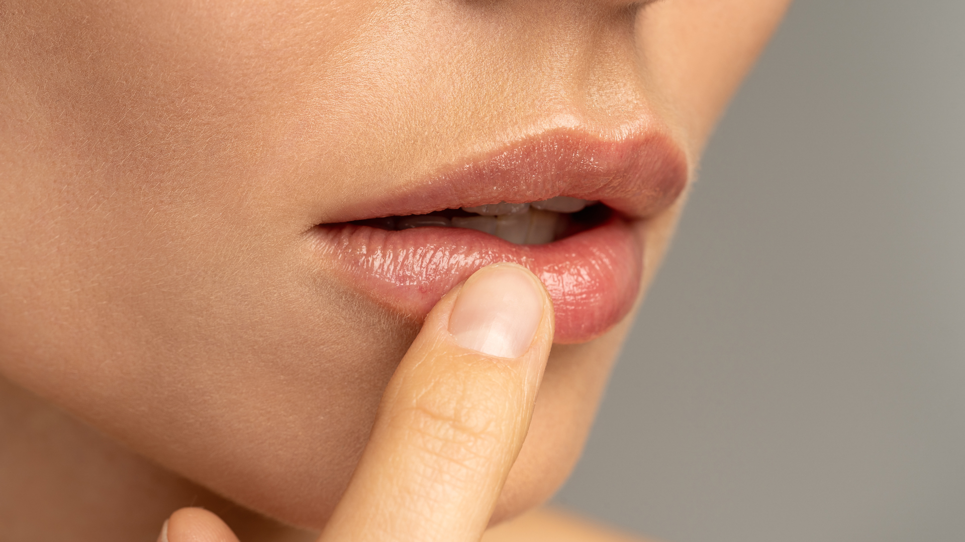 Efectos secundarios de un relleno de labios mal hecho